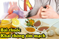 Bài Thuốc Thông Tim Mạch của thầy Đỗ Đức Ngọc